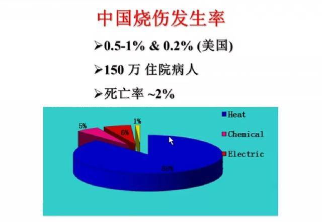 广东省烧伤发生率及其影响因素分析