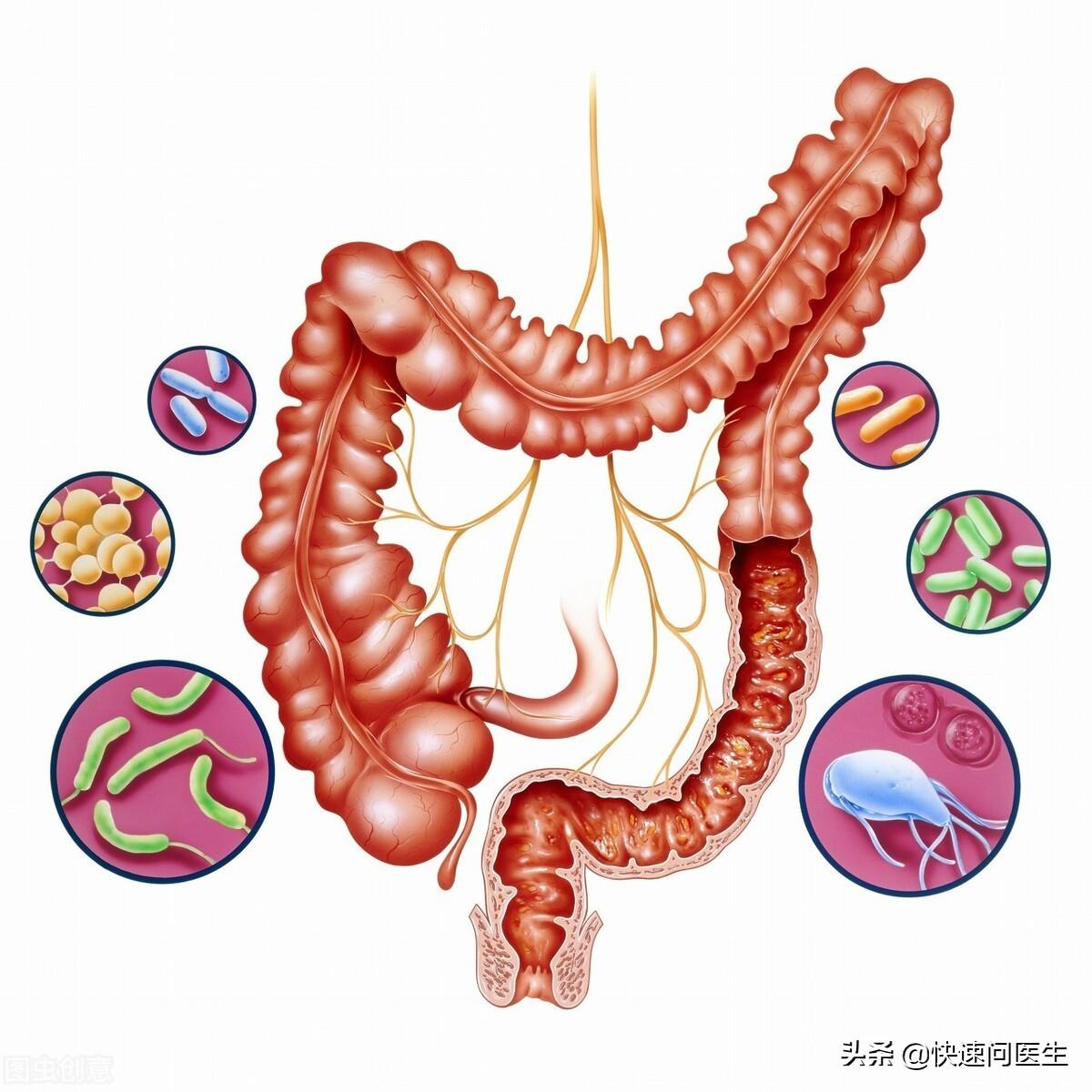 关于三个月宝宝两天未排便是否正常的问题